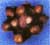 Image of Kidney Stone