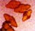 Image of Kidney Stone