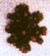 Image of Kidney Stone
